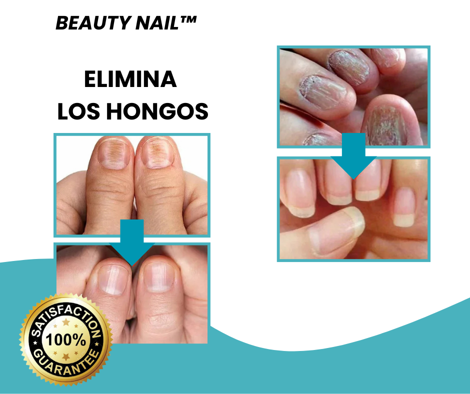 Repara tus uñas en 7 días - Beauty Nail™