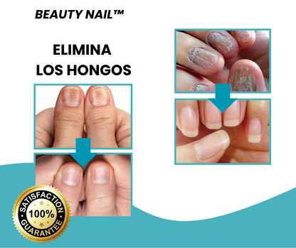 Repara tus uñas en 7 días - Beauty Nail™