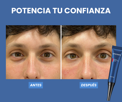 Elimina las ojeras y bolsas de tus ojos - OpenEye™ | 1+1 GRATIS 🎁