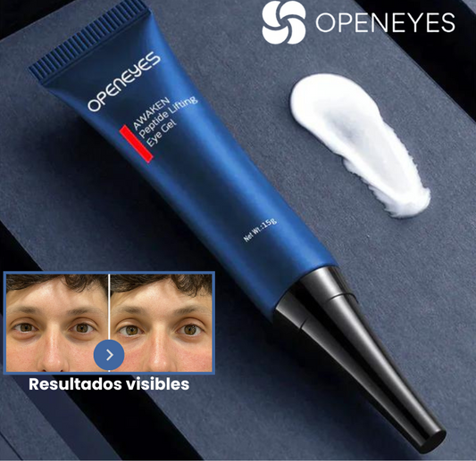 Elimina las ojeras y bolsas de tus ojos - OpenEye™ | 1+1 GRATIS 🎁