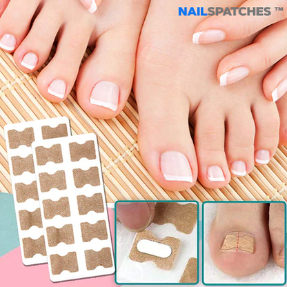 Recupera la confianza de unas uñas bonitas  - NailSpatches™ | 50% DESCUENTO 🎁