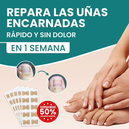 Recupera la confianza de unas uñas bonitas  - NailSpatches™ | 50% DESCUENTO 🎁