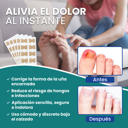 Recupera la confianza de unas uñas bonitas  - NailSpatches™ | 50% DESCUENTO 🎁