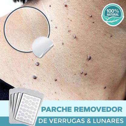 Elimina tus verrugas sin dolor - SkinTag™ | 50% DESCUENTO